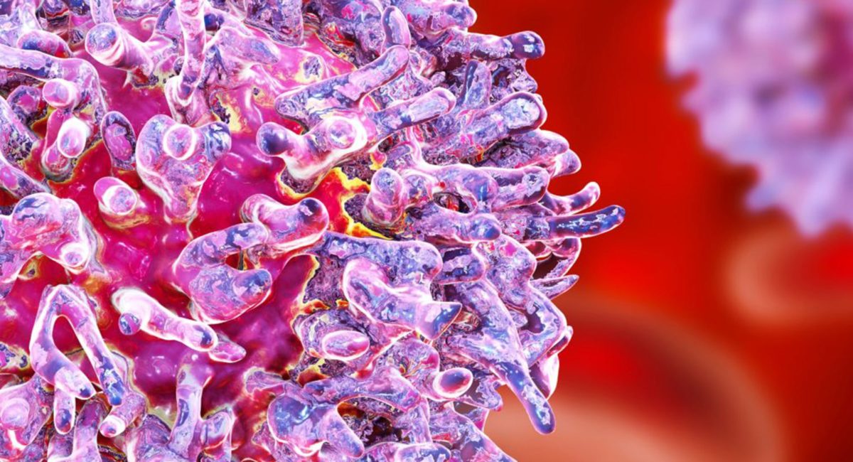 Gut bacteria influence the progression of multiple myeloma